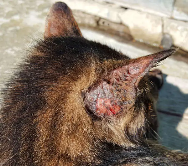 Sporotrichosis