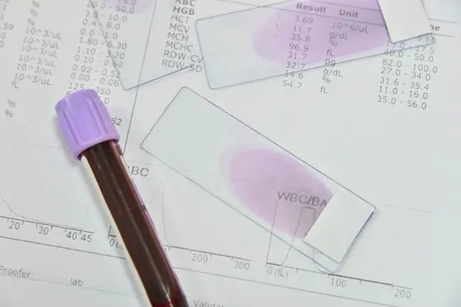 Complete blood count