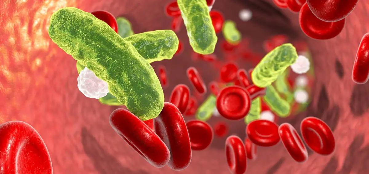 Sepsis in cats