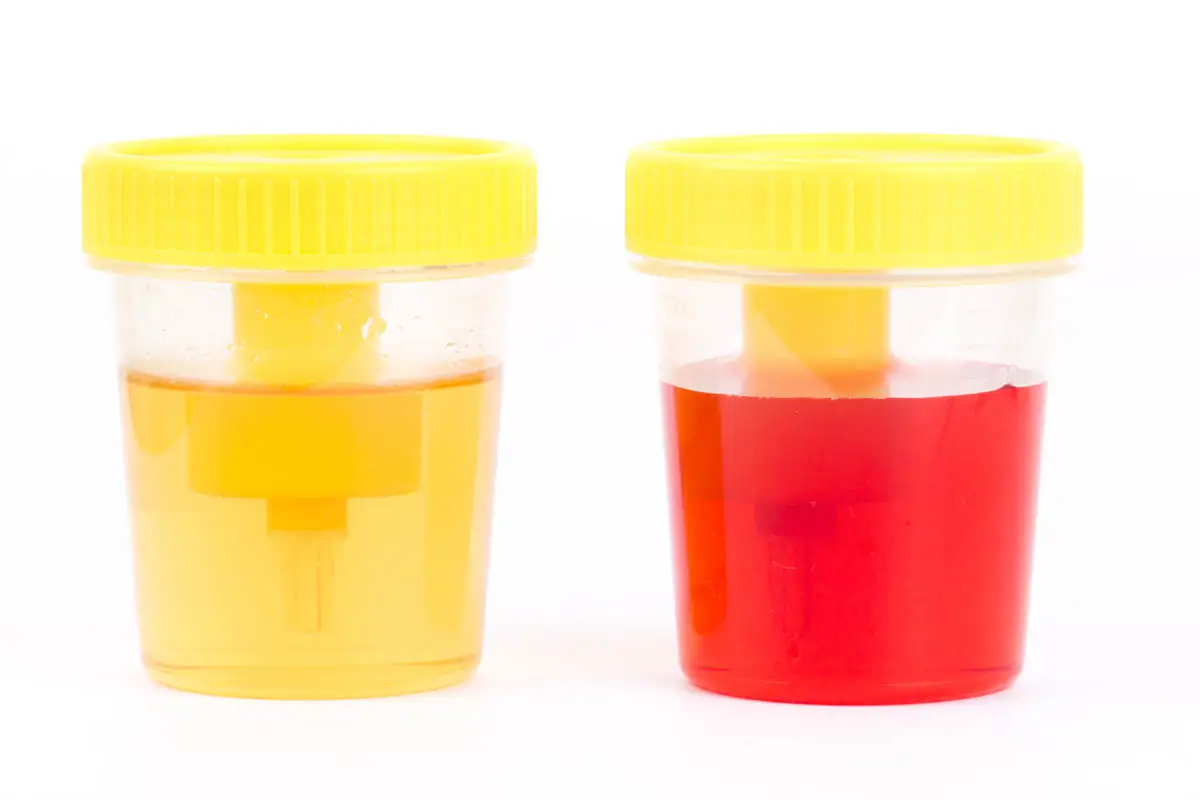 Hematuria in cats
