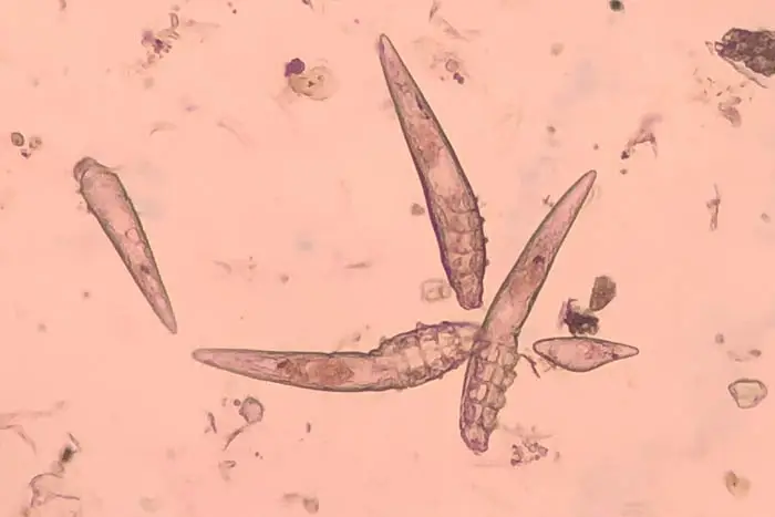 Demodex mite