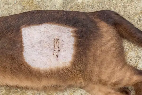 Lump surgery stitches