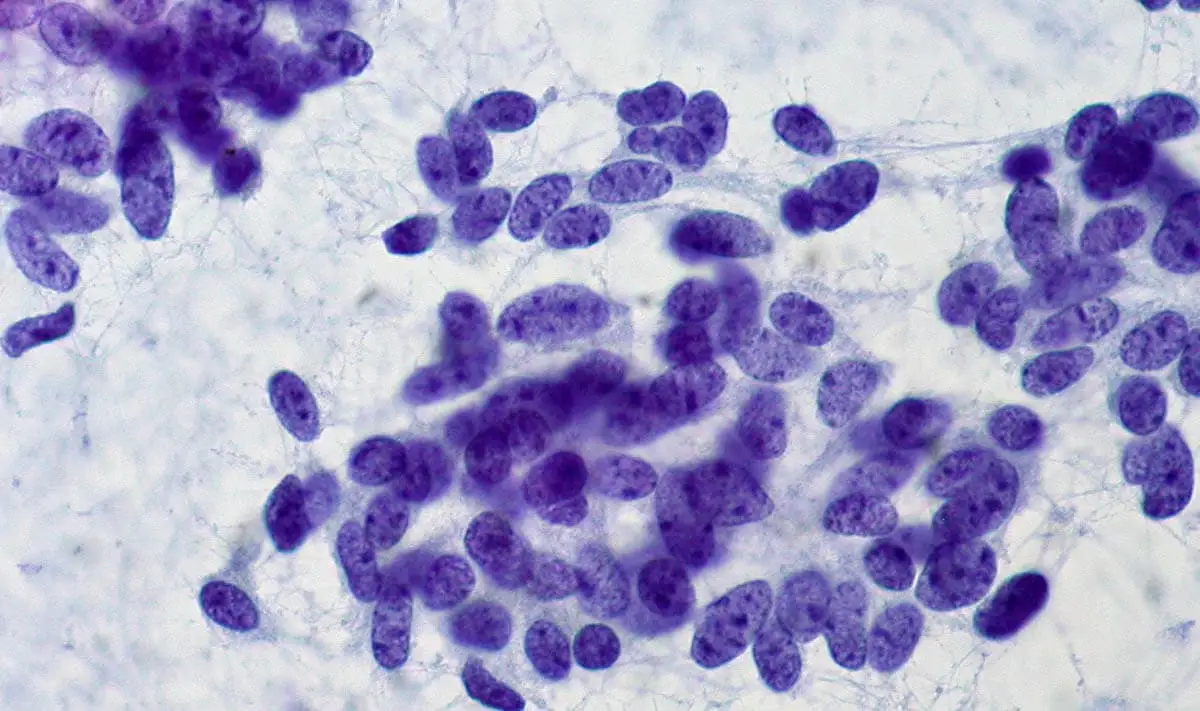 Cytology