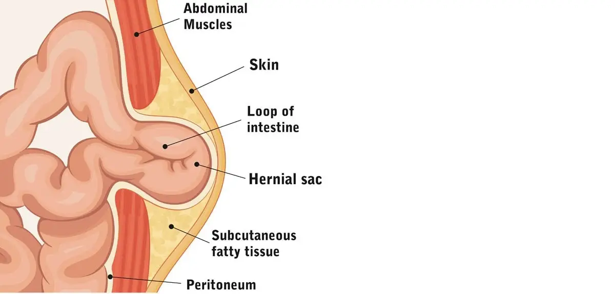 Umbilical hernia in cats