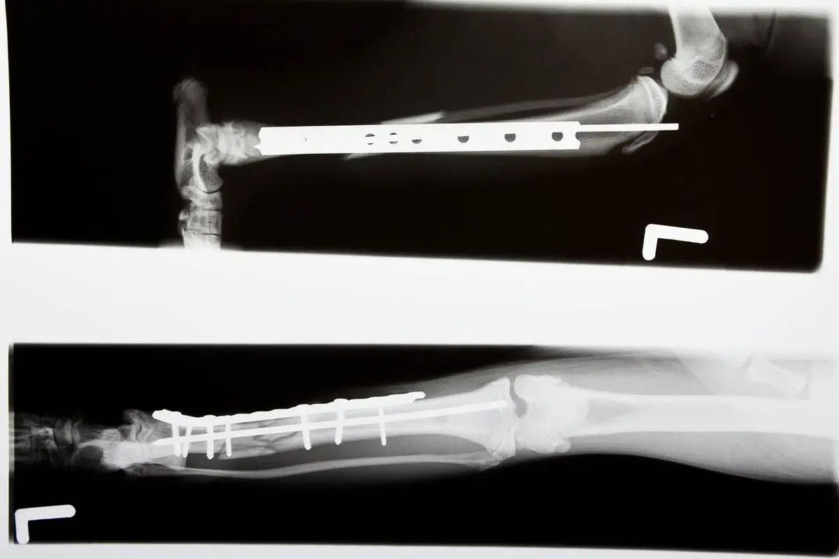 Internal fixation on a broken cat