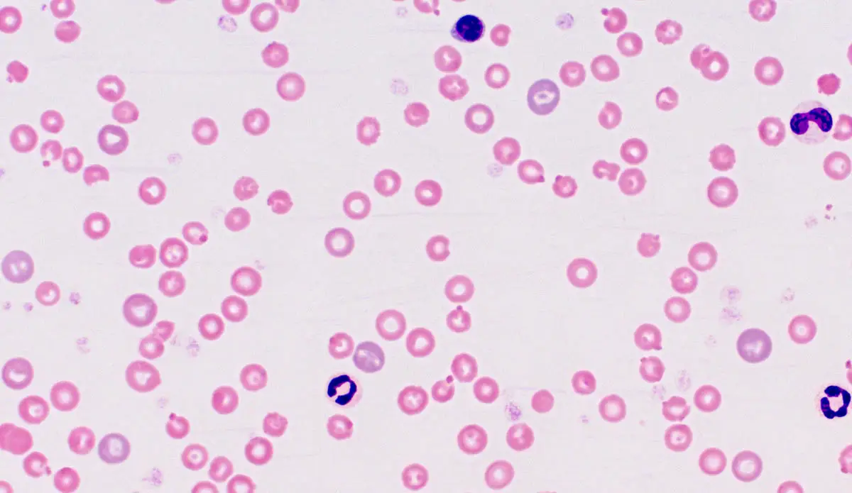 Heinz body anemia in cats