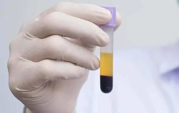 Blood serum