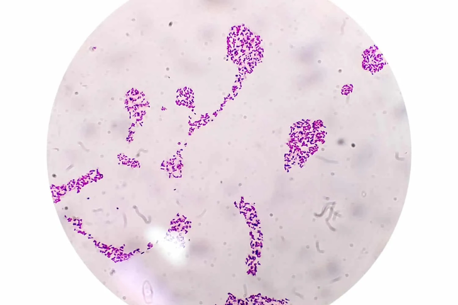 Veriagar-bakteeripesäkkeet gramvärjätyt mikroskooppiset osoittavat Salmonella Typhi (S. Typhi) -bakteeria' title=