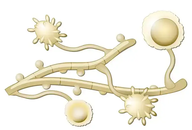 Histoplasmosis in cats