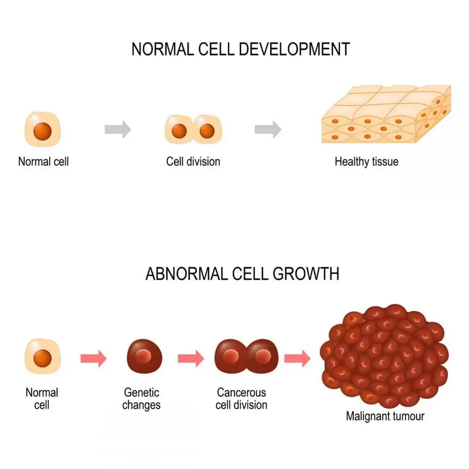 How cancer develops