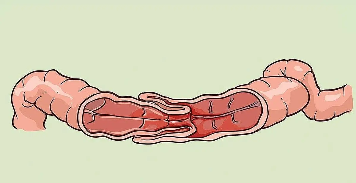 Telescoping of the intestines in cats