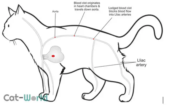 Saddle thrombosis