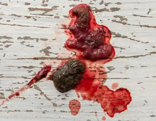 bloody diarrhea on floor