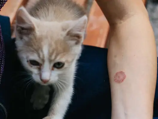 ringworm contagion from cat to human