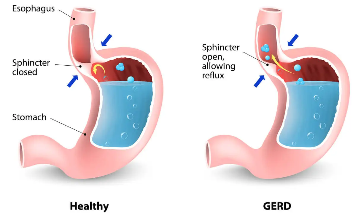 Reflux in cats