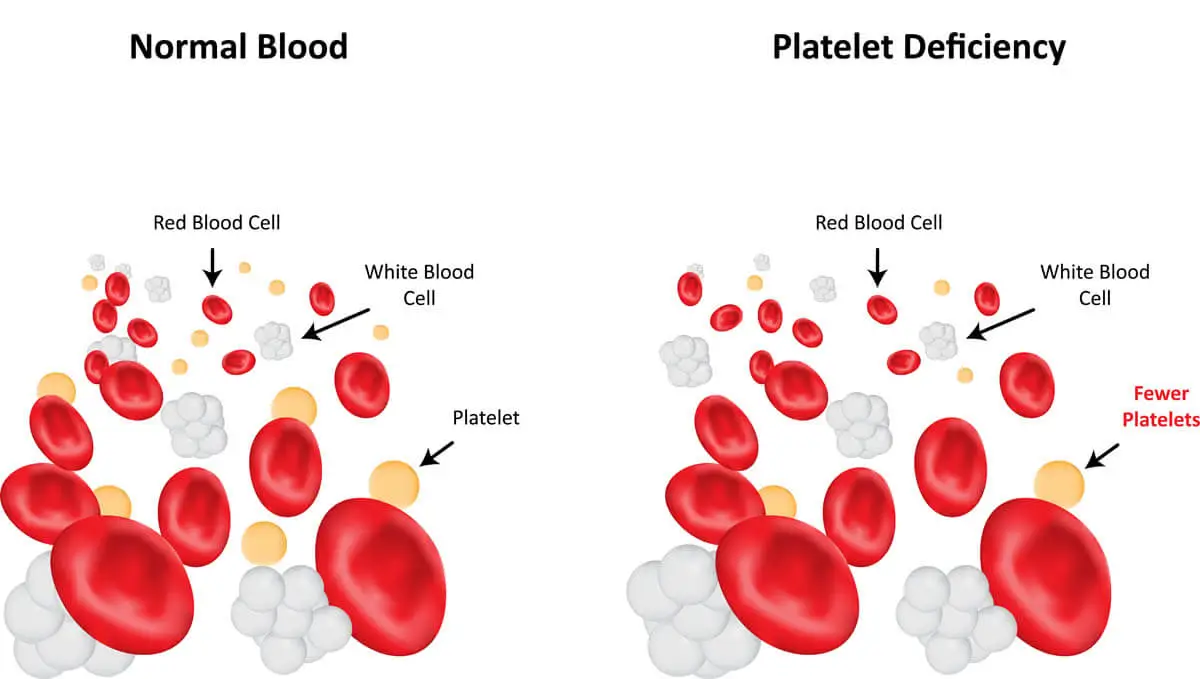 Low blood platelets in cats