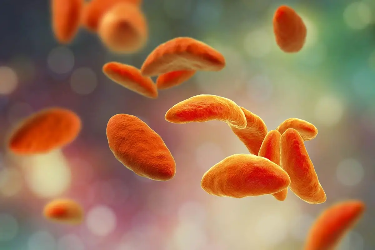How to prevent toxoplasmosis