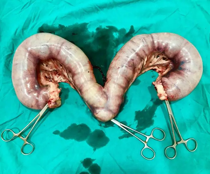 Pyometra