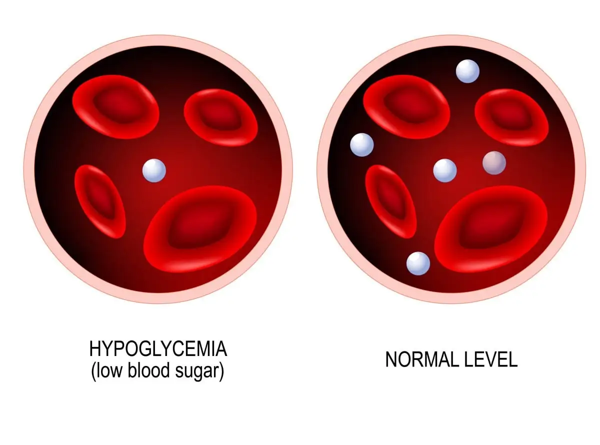 What is hypoglcemia?