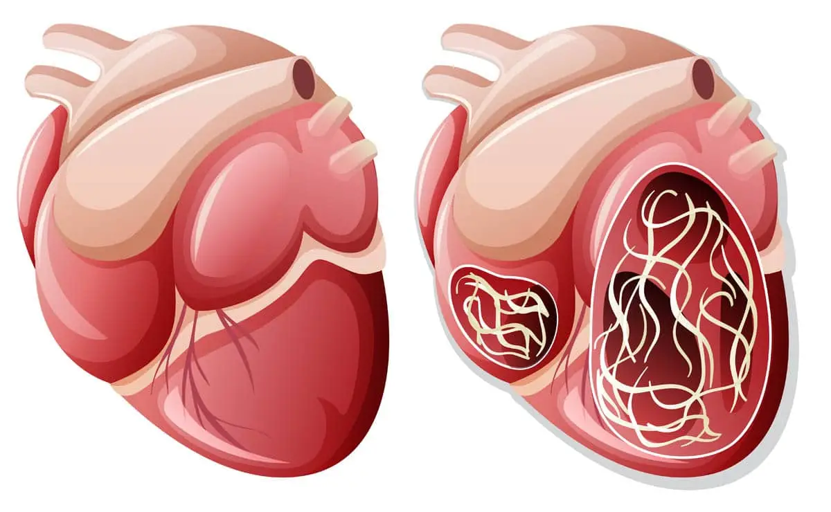 Heartworm disease