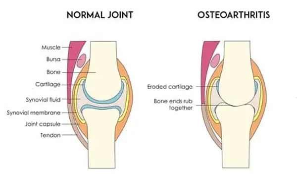 Arthritis in cats