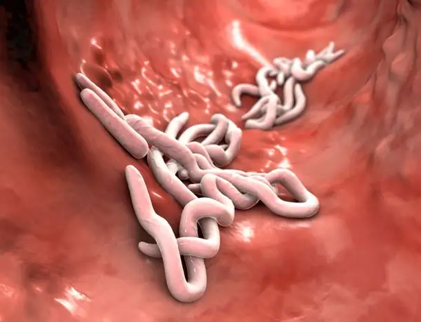 illustration of worms in blood vessels