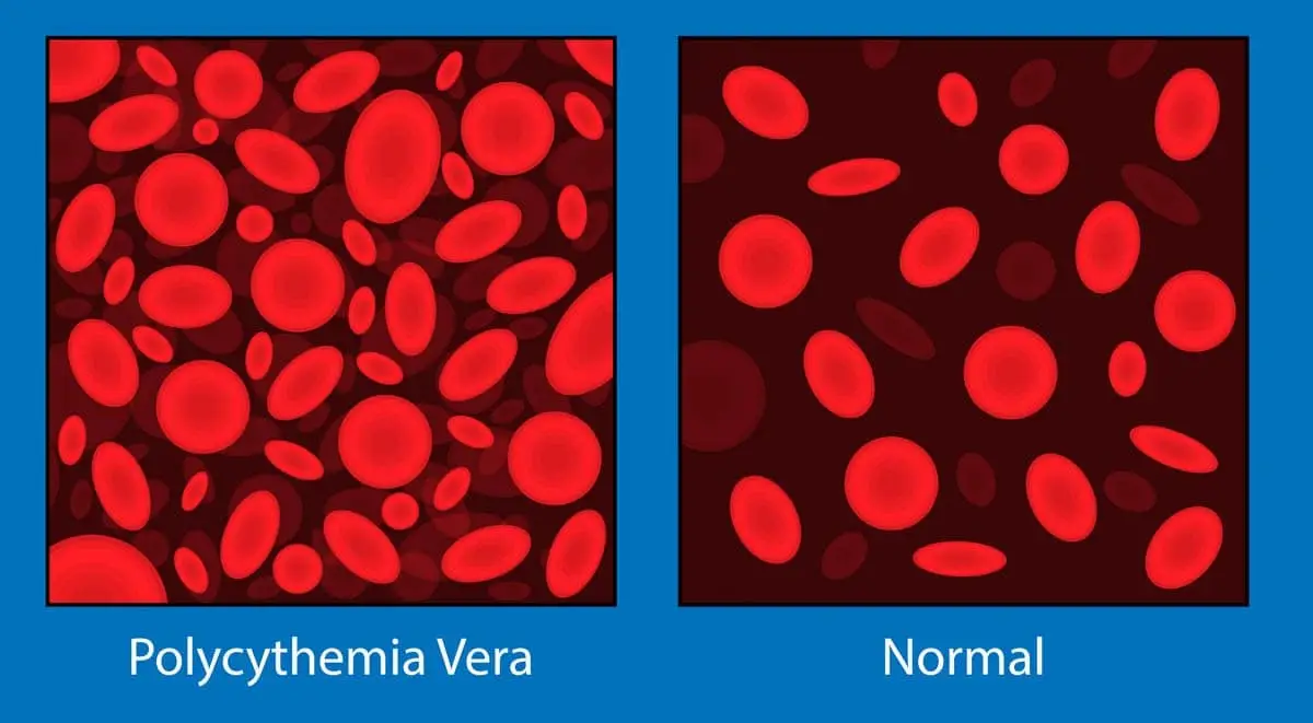 polyncemia في القطط
