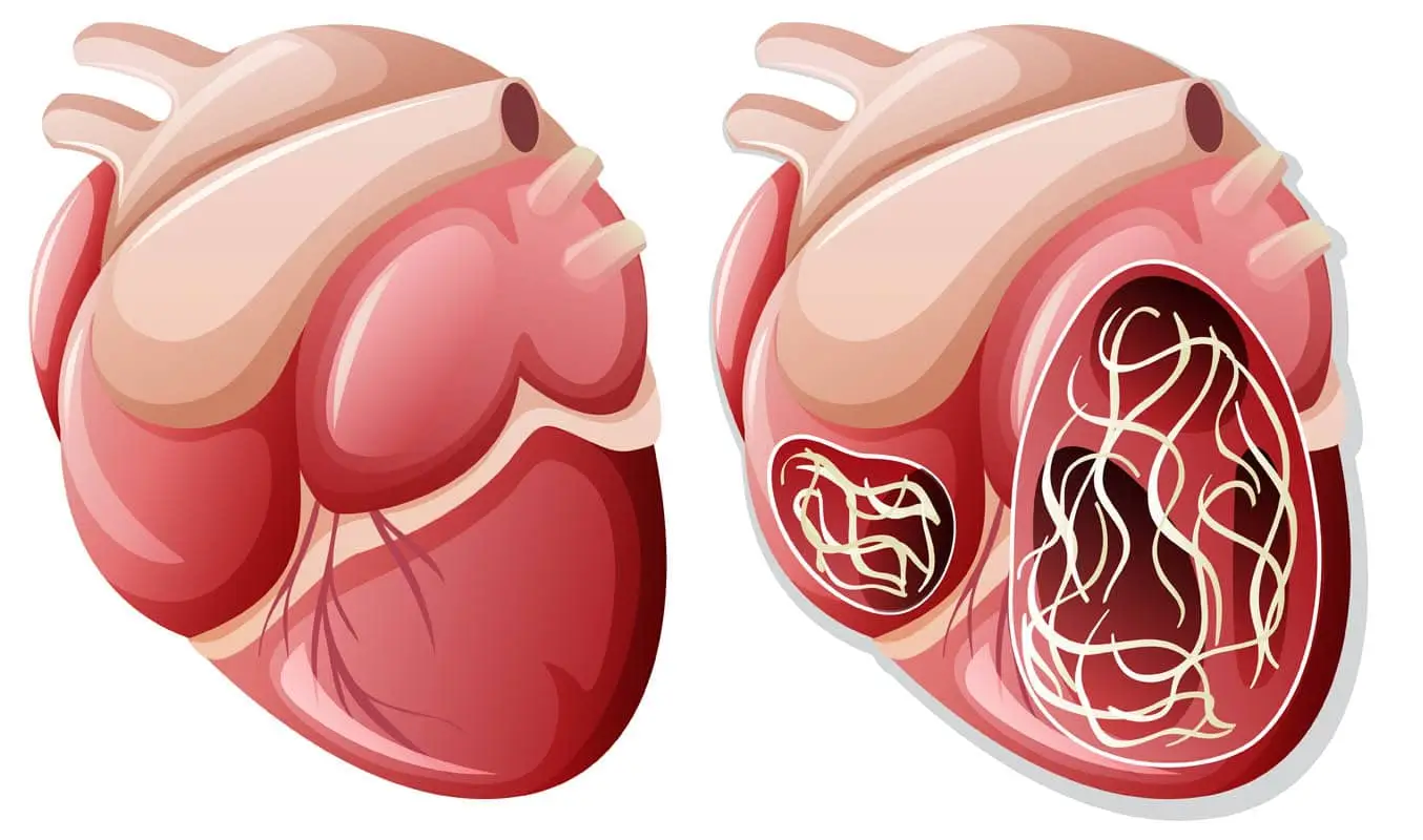 Heartworm disease