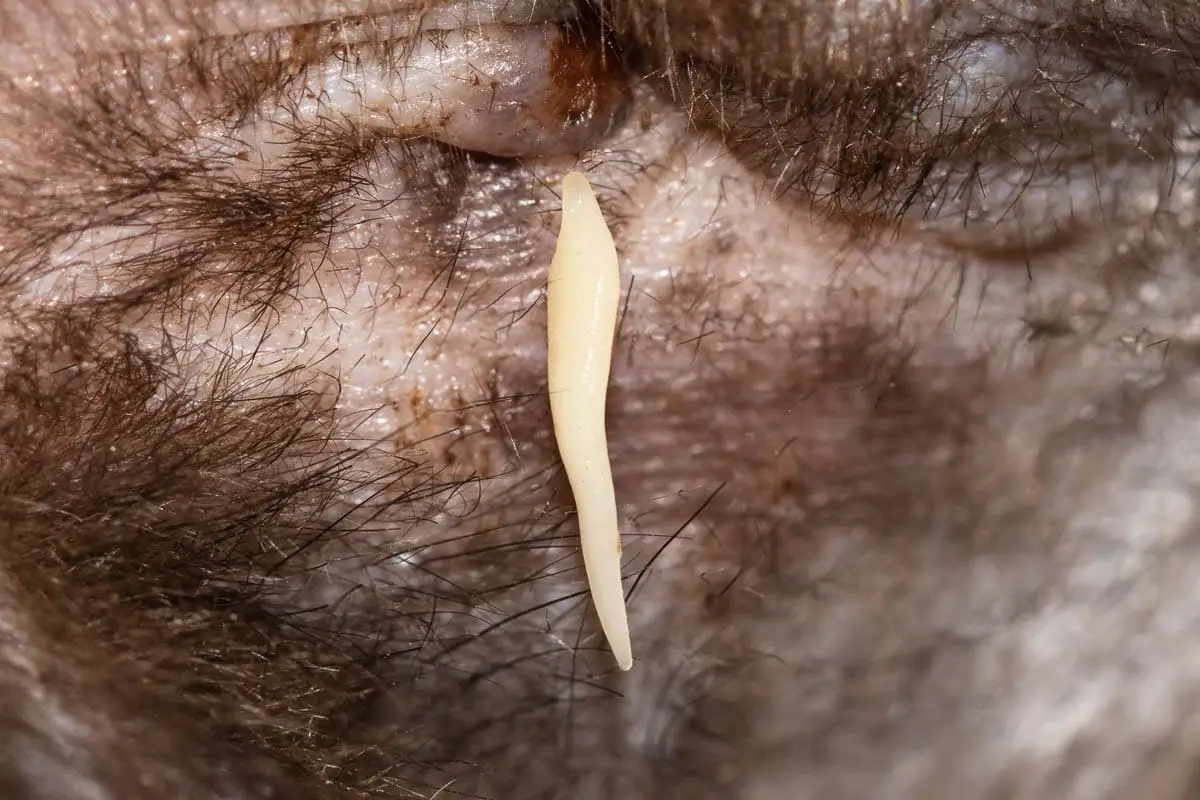 Tapeworm proglottid