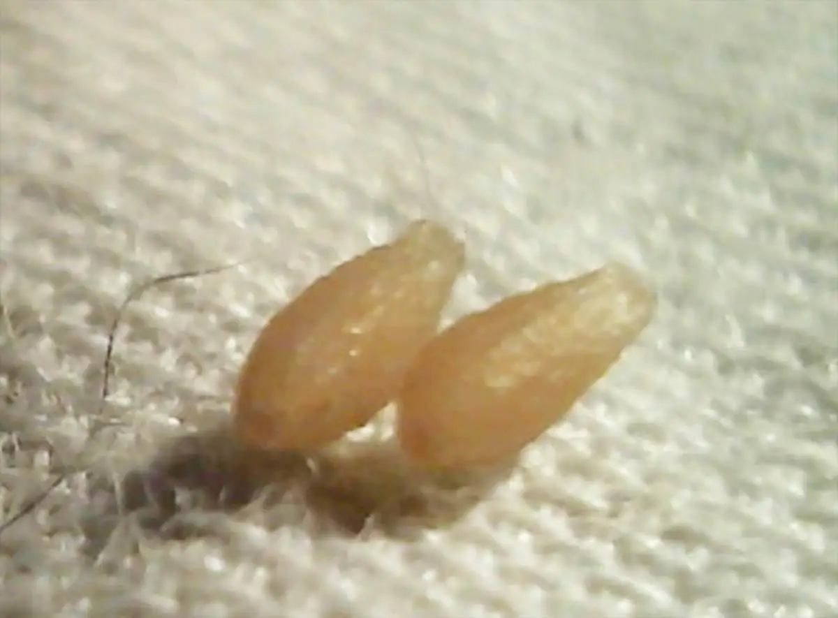Tapeworm eggs