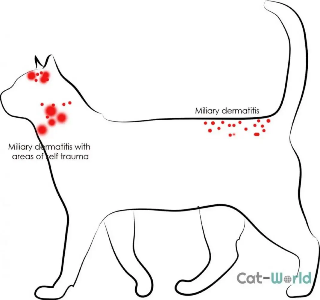 Miliary dermatitis