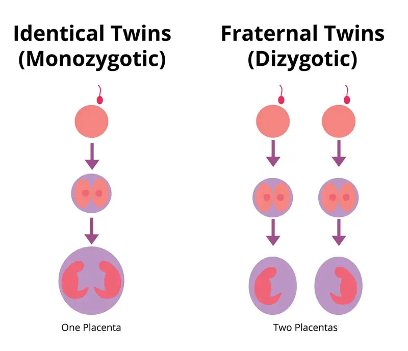 Monozygotic and dizygotic twins
