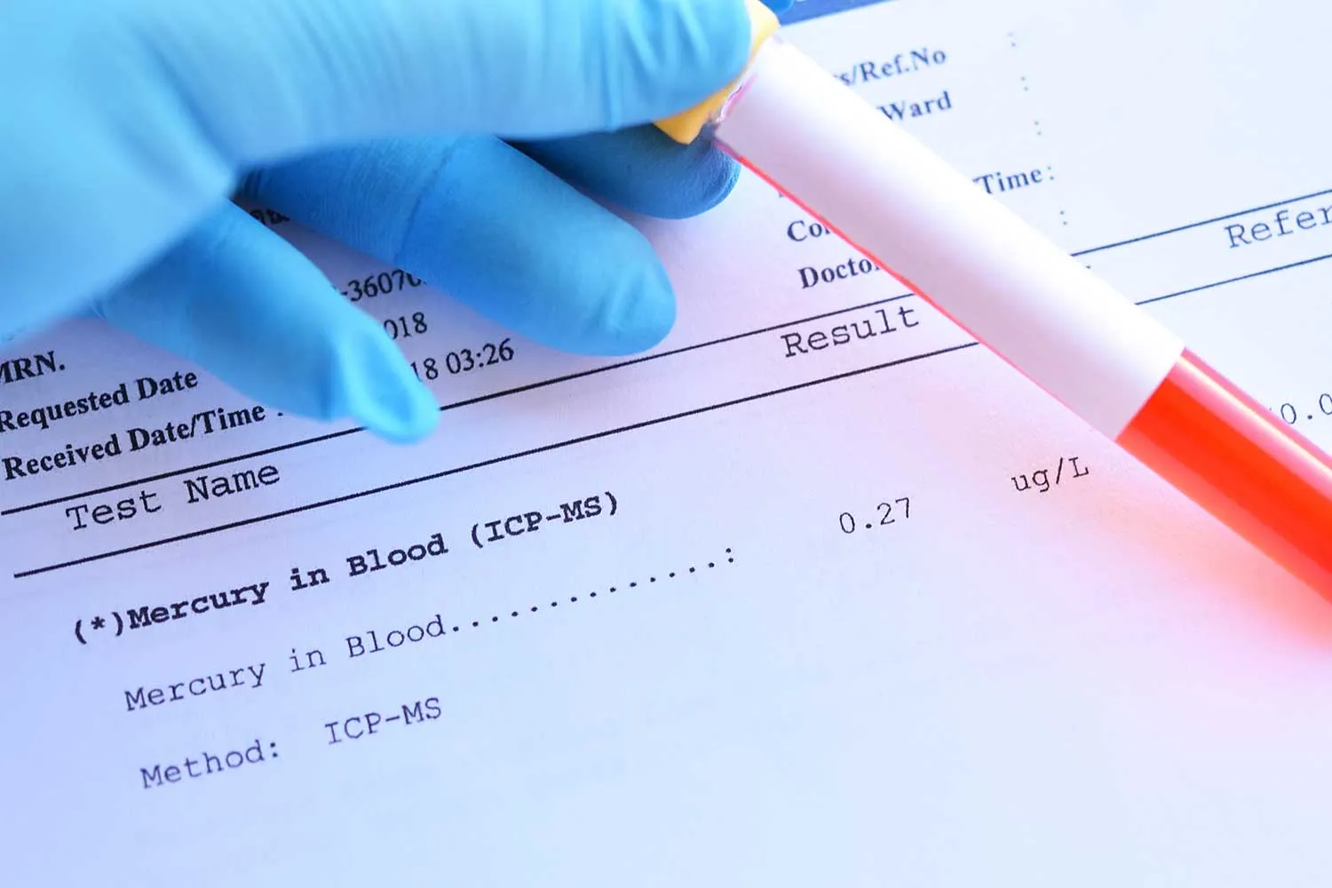 Kraujo mėginio mėgintuvėlis su normaliu gyvsidabrio tyrimo rezultatu' title=