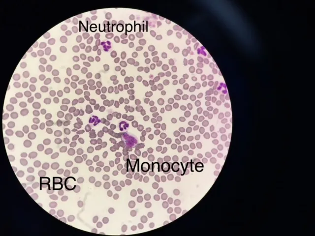 Macskavérvizsgálati eredmények magyarázata' title=